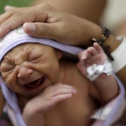 Brain damage in Zika babies is far worse than expected