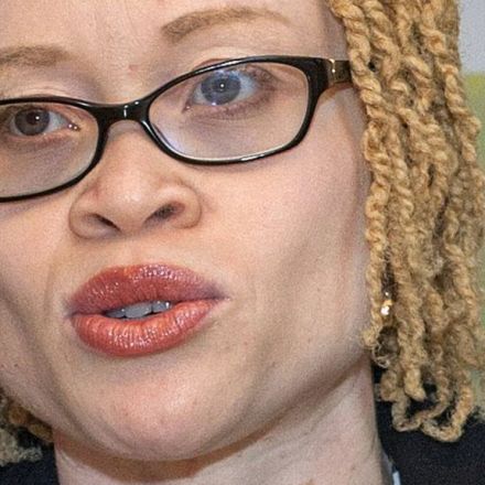 People with albinism in Malawi face 'total extinction'