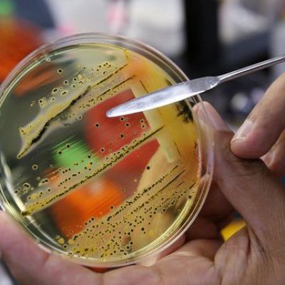 The 12 bacteria that pose the greatest threat to human health