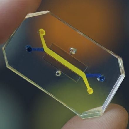 Human Organs-on-Chips - Microchips lined by living human cells that could revolutionize drug development