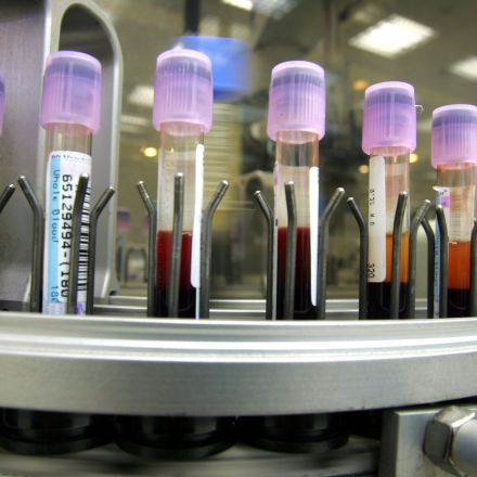 New Blood Test Could Reduce Harmful Effects Of Sports Concussions