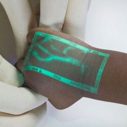 Handy Device Shows Where Patient's Veins Are Located