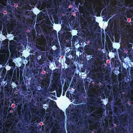 A New Approach to Alzheimer’s: Restore Defective Brain Waves