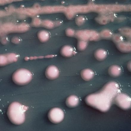 Deadly superbugs may be spreading, evolving quietly among the healthy