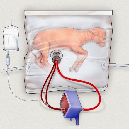 Scientists Create Artificial Womb That Could Help Prematurely Born Babies