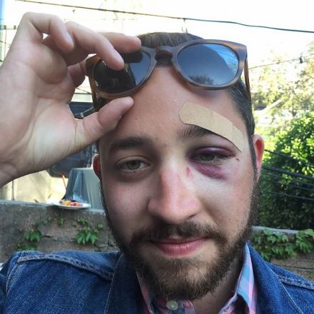 New York Man Punched in the Face on Subway Because He 'Looks Exactly Like Shia LaBeouf'