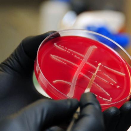 'Nightmare Bacteria' Superbug Found for First Time in U.S