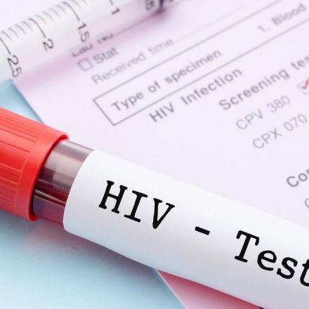 New HIV Vaccine Trial to Start in South Africa
