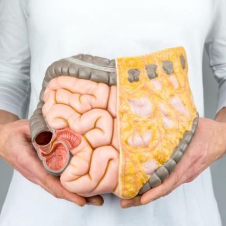 Food additive alters gut bacteria to cause colorectal cancer