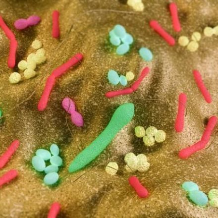 Gut microbiome contributes to Parkinson's, study suggests