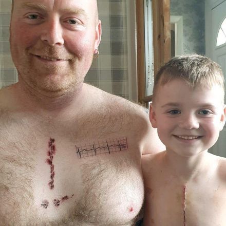 Father gets tattoo on chest to match son’s heart surgery scar