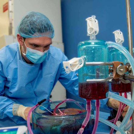 Transplant organs can be supercooled to below zero for longer storage