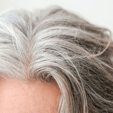 Grey hair and wrinkles at an early age led researchers to new treatment for rare cancer