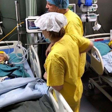 Twins Born Conjoined at the Head Are Separated Successfully
