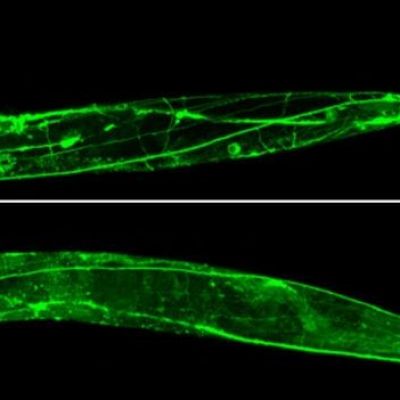 Worms in space to understand muscle loss