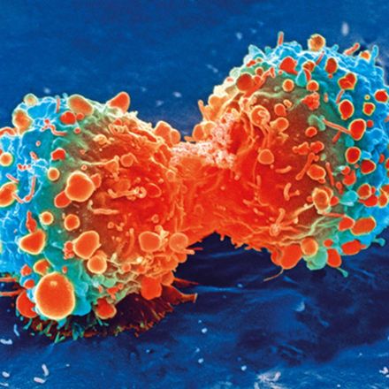 Revolutionary CRISPR-based genome editing system treatment destroys cancer cells