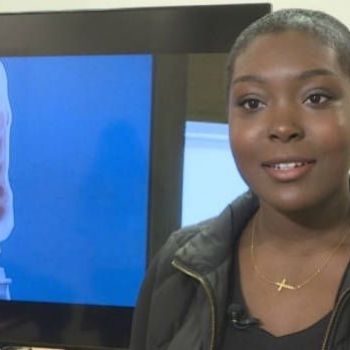 Alberta woman 1st adult in Canada to be 'cured' of sickle cell anemia through stem cell transplant