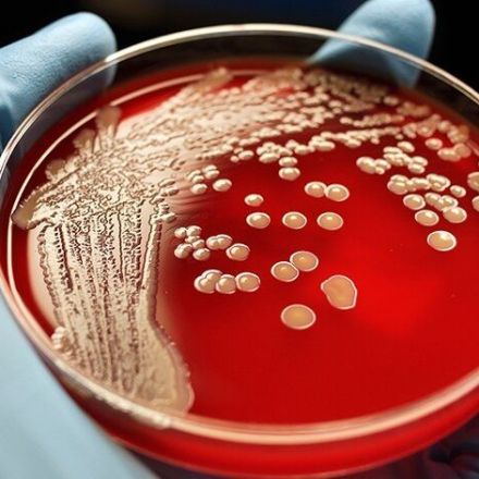 Scientists develop new compound which kills both types of antibiotic resistant superbugs