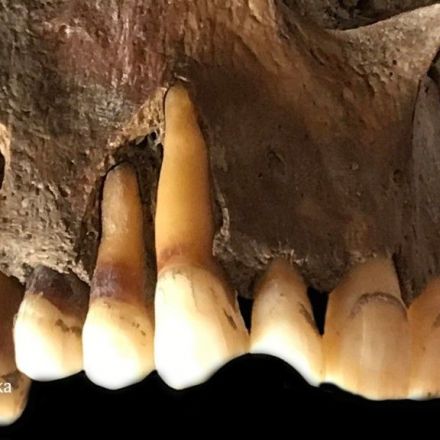Ancient tooth DNA reveals how ‘cold sore’ herpes virus has evolved