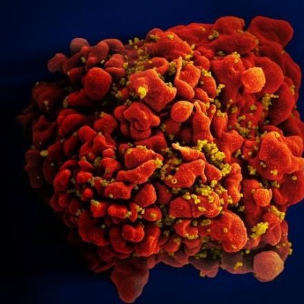 Oldest 'nearly complete' HIV genome found in forgotten tissue sample from 1966