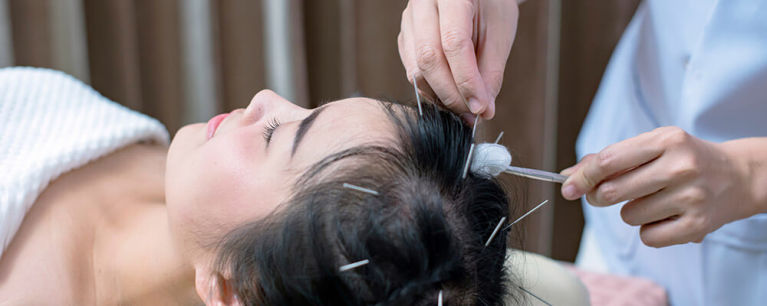 Visit us at: https://www.jacksonvillechiropractic.com/2019/01/16/how-acupuncture-treatment-helps-in-hair-loss-problem/<br />
