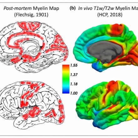 People With Advantageous Personality Traits Have More Nerve-Fibre Insulation (Myelination) In Key Brain Areas