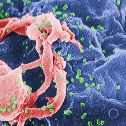 In a first, a person’s immune system fought HIV — and won