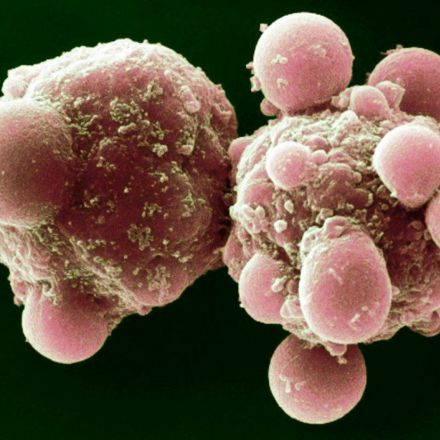 A cell-killing strategy to slow aging passed its first test this year