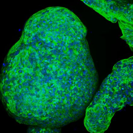 Engineers grow pancreatic “organoids” that mimic the real thing