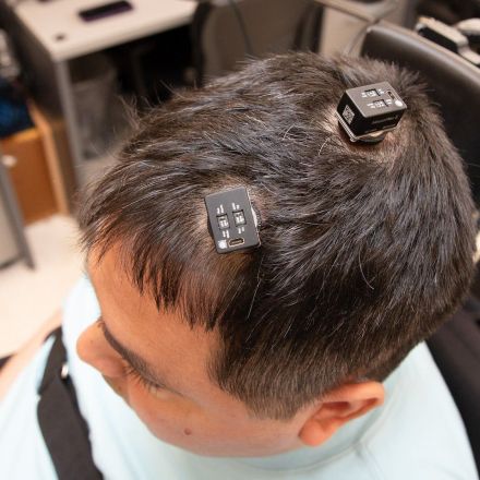 First-of-its-kind AI brain implant surgery helped a man regain feeling in his hand