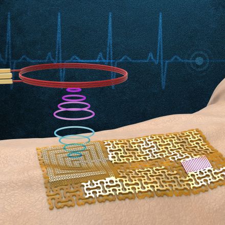 Engineers fabricate a chip-free, wireless electronic “skin”