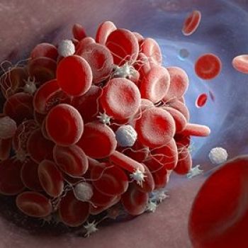 COVID-19 Causes ‘Hyperactivity’ in Blood-Clotting Cells