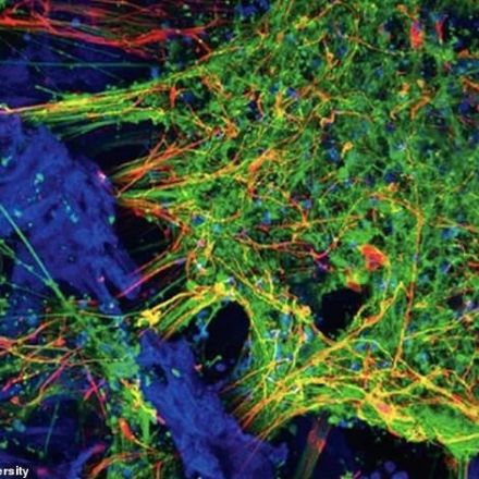 Scientists may be able to grow replicas of human BRAINS in a lab