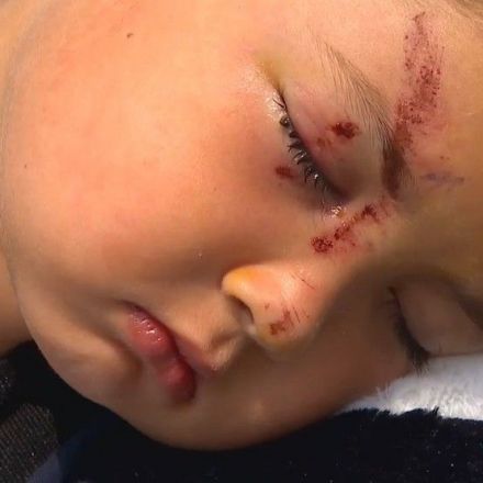 Olympia 6-year-old ends up in hospital after standing up to bullies