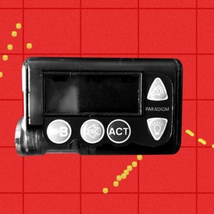 People Are Clamoring to Buy Old Insulin Pumps