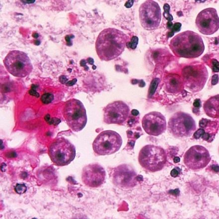 Brain-eating amoeba found in Brazosport water supply