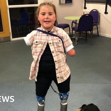 Girl, 8, is youngest to get computerised knee prosthetics