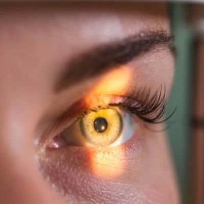 Retinal Tissue Restored in Patients with Dry AMD, Heralding Paradigm Shift