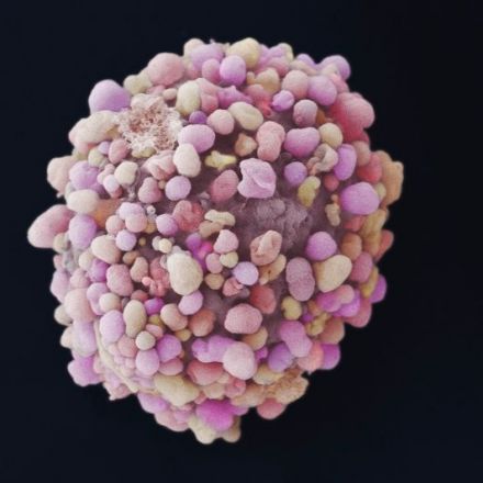 New evolution-busting drug overcomes resistance in aggressive breast cancers - The Institute of Cancer Research, London