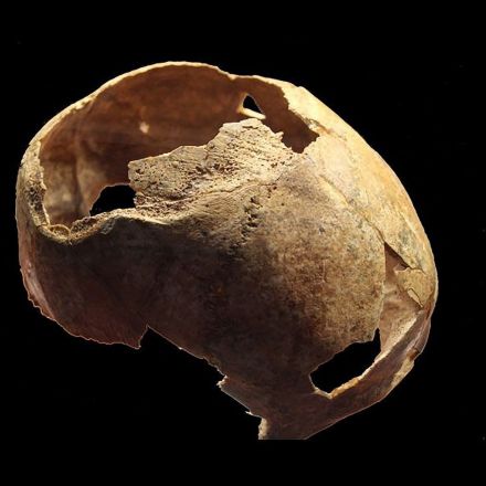 Russian Scientists Find A 5,000 Year-Old Skull Of A Person Who Seems To Have Undergone A Failed Brain Surgery