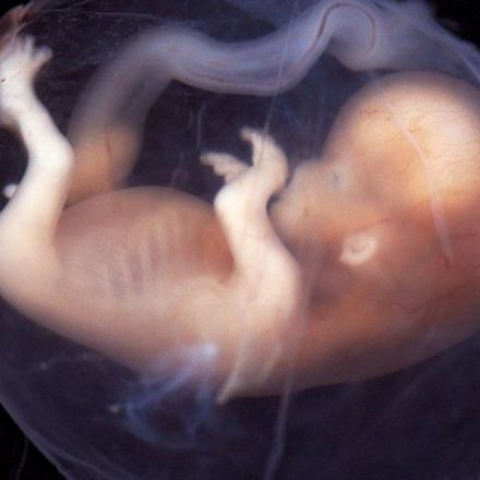 Artificial human embryos are coming, and no one knows how to handle them
