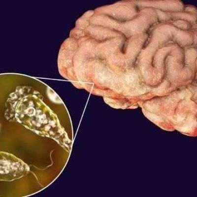 Brain-eating amoebae halted by silver nanoparticles