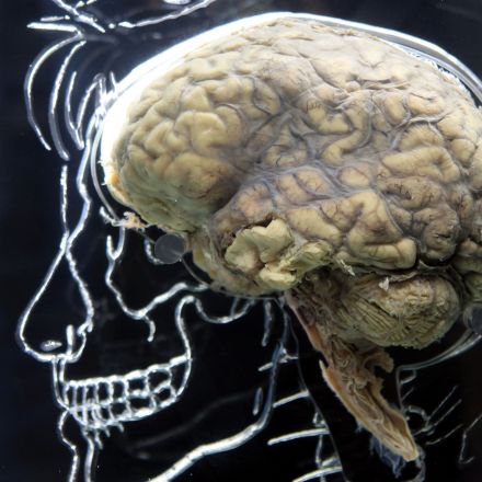 DARPA scientists unveil brain device that boosts learning by 40 percent