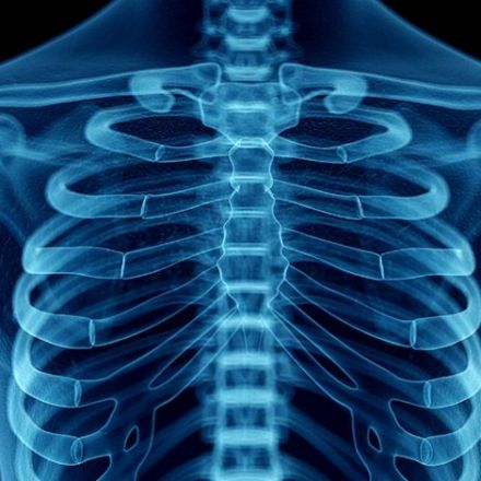 AI dramatically cuts time to process chest X-rays