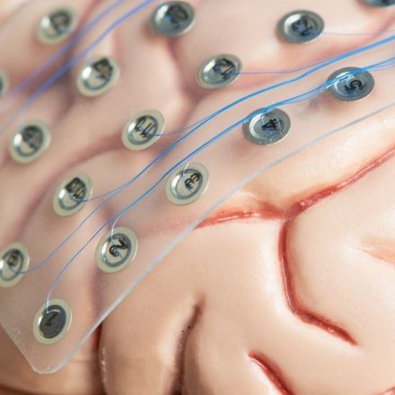 Blind people could 'see' letters that scientists drew on their brains with electricity