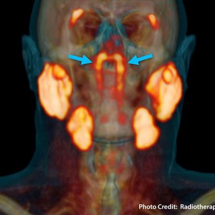 Scientists Discover New Organs in the Throat