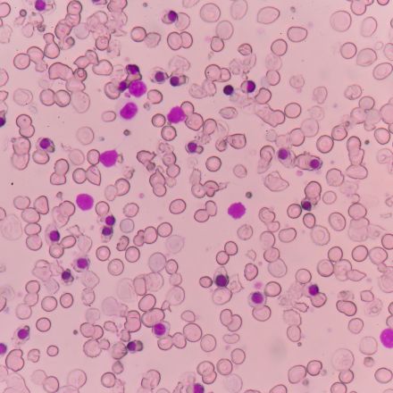 A Stunning Gene-Therapy Cure for Beta Thalassemia, One of the World’s Most Devastating Blood Diseases