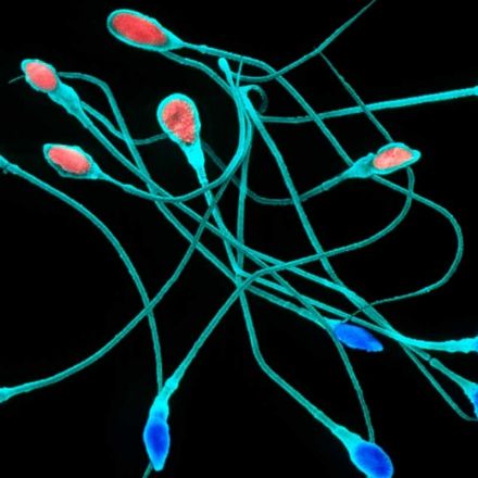 First attempt to get CRISPR gene editing working in sperm