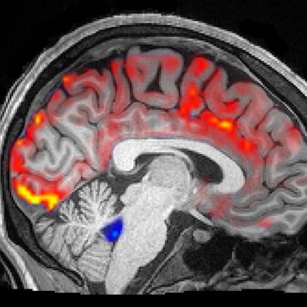 How Deep Sleep May Help The Brain Clear Alzheimer's Toxins
