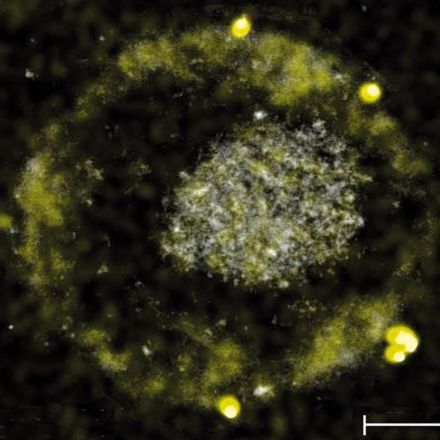 Weird Science: Bacteria that poop gold nuggets